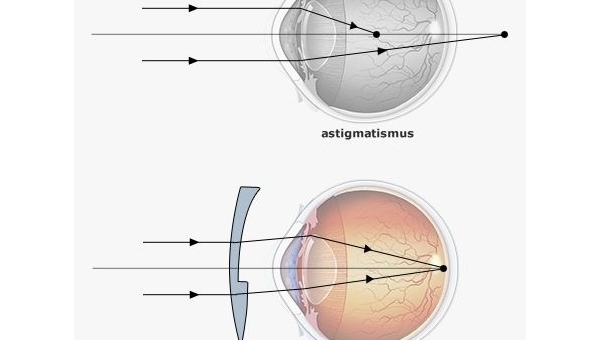 Oční vady